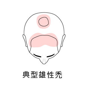 適合我嗎_2