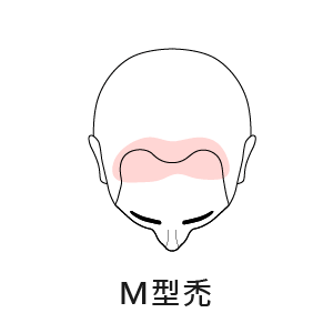 適合我嗎_3