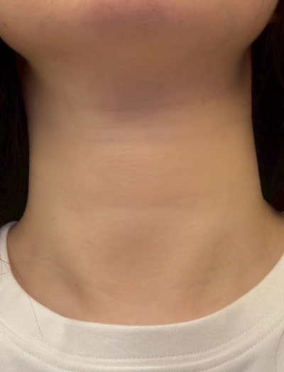 Neck_test_Anna