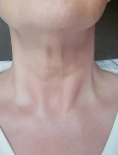 Neck_test_Sarah