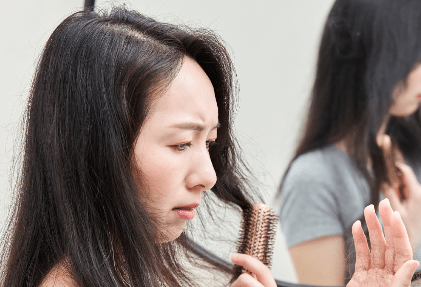 掉髮原因 女性雄性禿