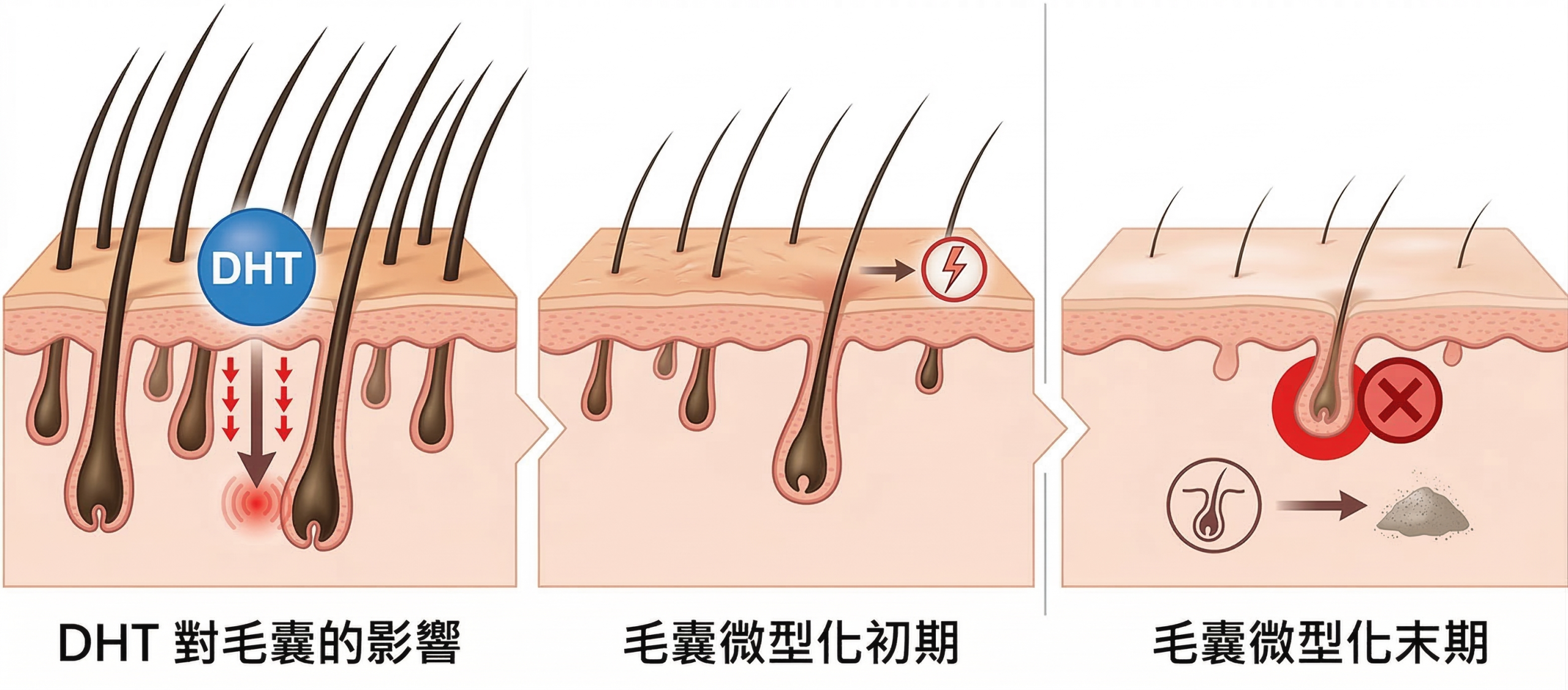 掉髮原因 皮膚疾病