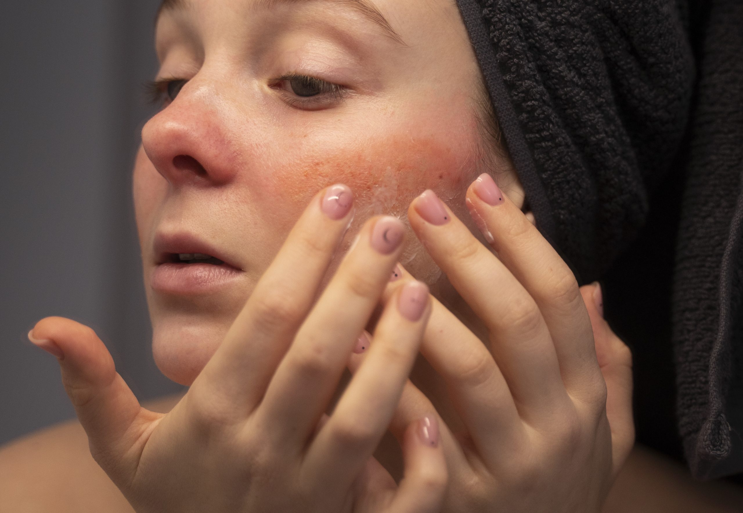 有臉泛紅困擾的人