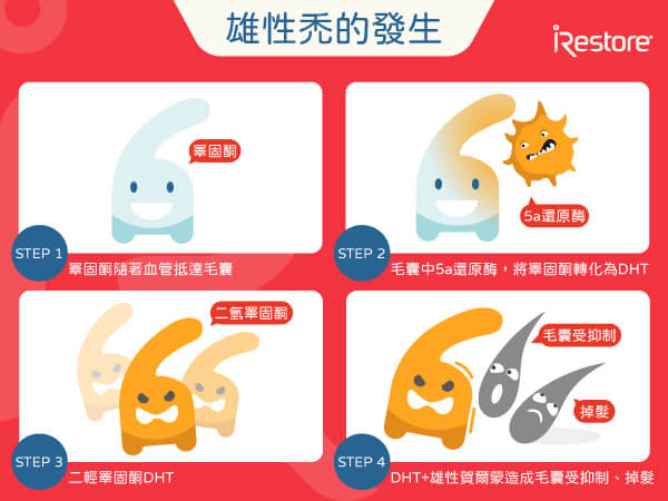 雄性禿的發生示意圖